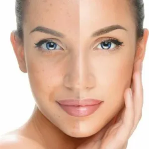 العناية بالبشرة والجسم